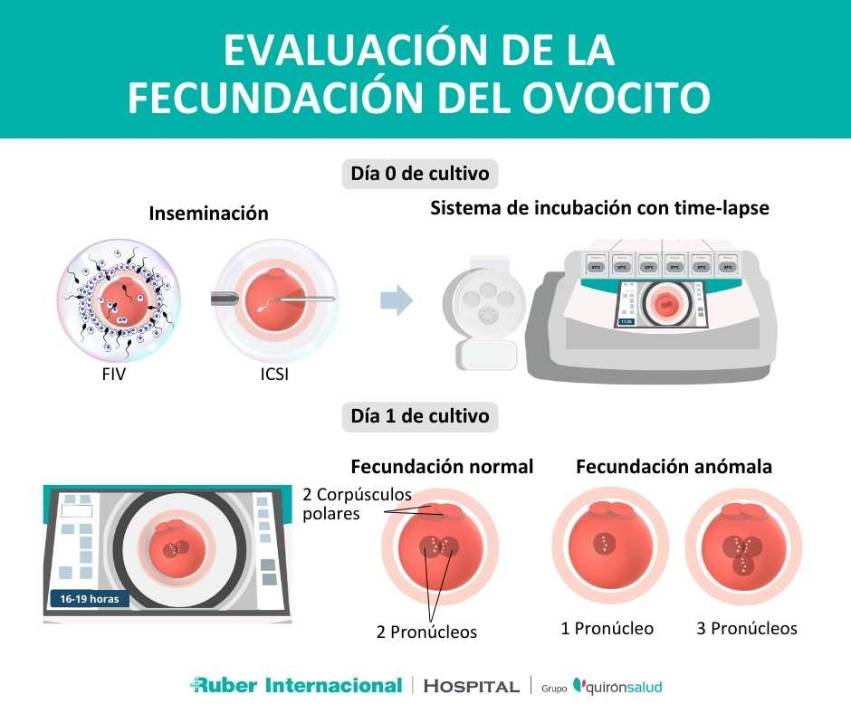 Fecundación del óvulo por espermatozoide FIV Notmal ICSI