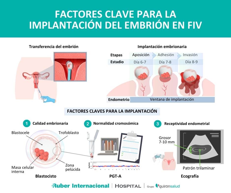 Implantación embrión FIV embarazo morfología endometrio