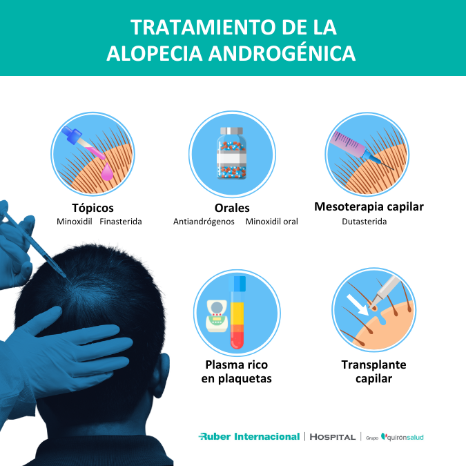 Tratamiento de la alopecia androgénica en hombres