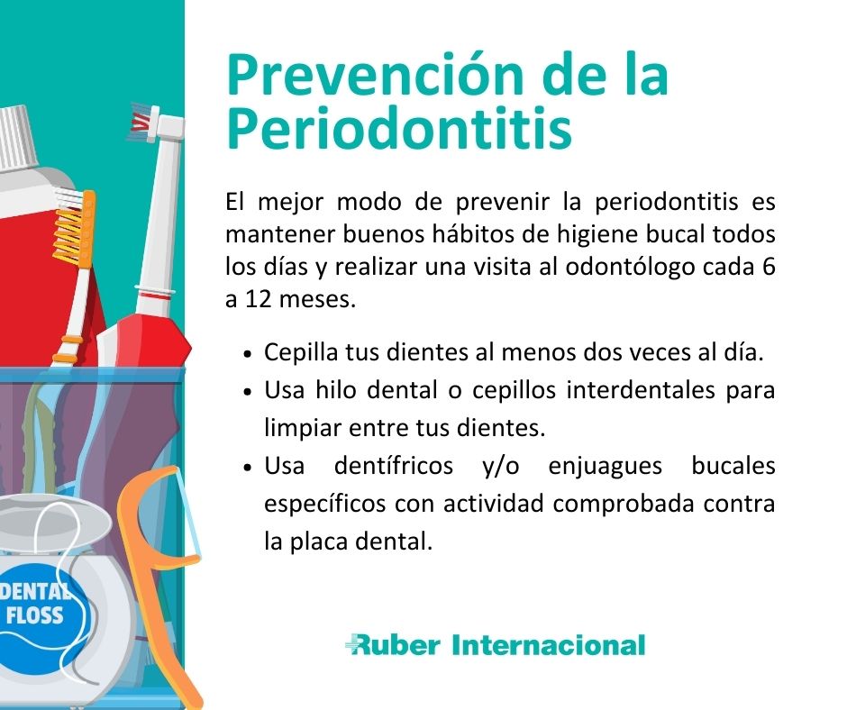 Periodontitis: Medidas de prevención y salud de las encías