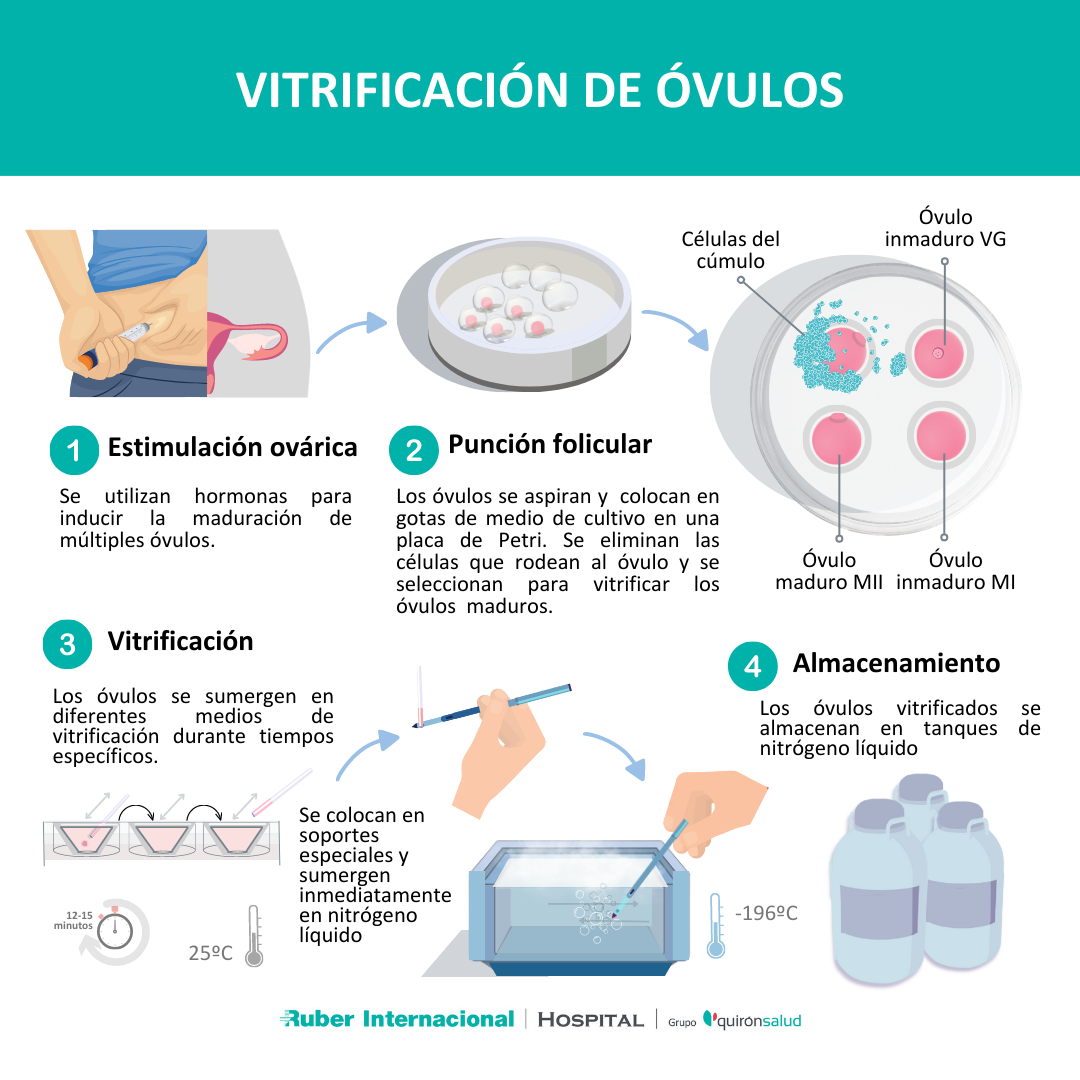 Vitrificación de óvulos