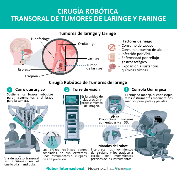 Tratamiento de tumor de faringe y tumor de laringe con cirugia robótica transoral
