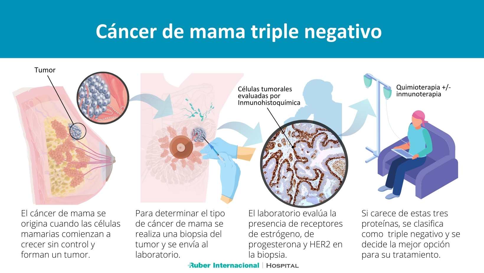 Cáncer de mama triple negativo doctor Javier Cortes Hospital Ruber Internacional