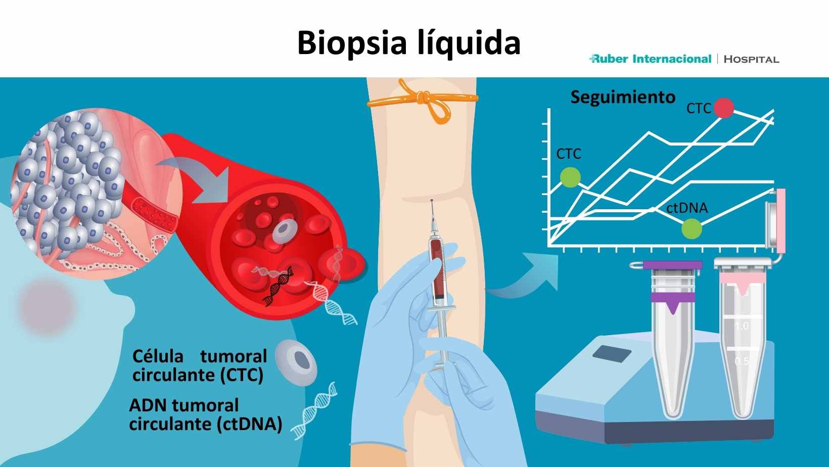 Cáncer de mama biopsia líquida diagnóstico precoz dr Javier Cortés Hospital Ruber Internacional