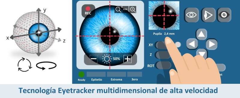Eyetracker Cirugía láser transepi Teneo 317 modelo 2 Hospital Ruber Internacional