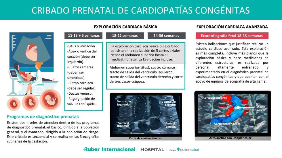 Cribado prenatal de cardiopatías congénitas en el hospital Ruber internacional