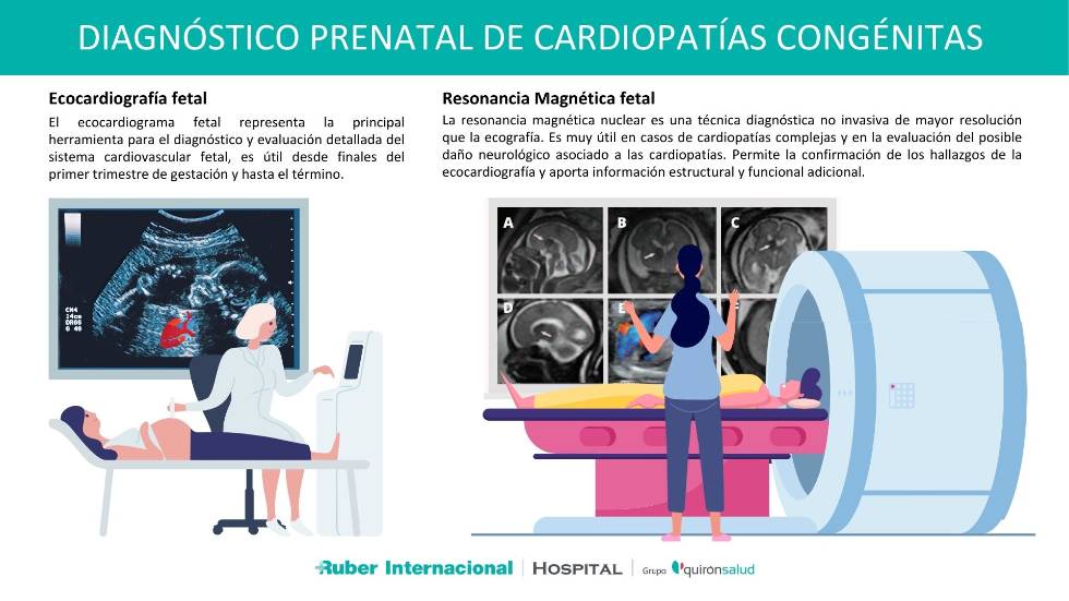 Resonancia Magnética Fetal para el diagnóstico de las cardiopatías Congénitas