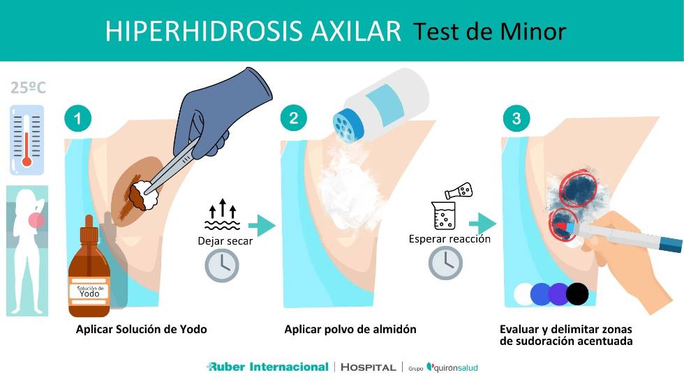 Prueba para Hiperhidrosis axila Test de Minor Hospital Ruber Internacional