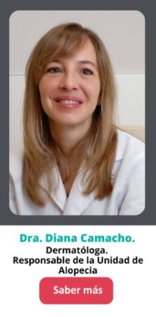 Doctora Diana Camacho. Tratamiento de Alopecia.