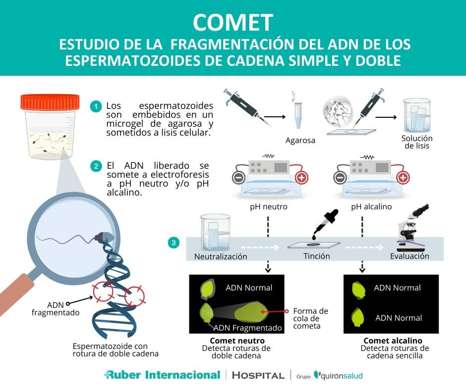 Fragmentacion de adn espermatozoides COMET diagnostico