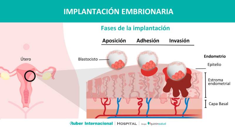 Endometrio e Implantación de embriones en Rerpoducción Asistida