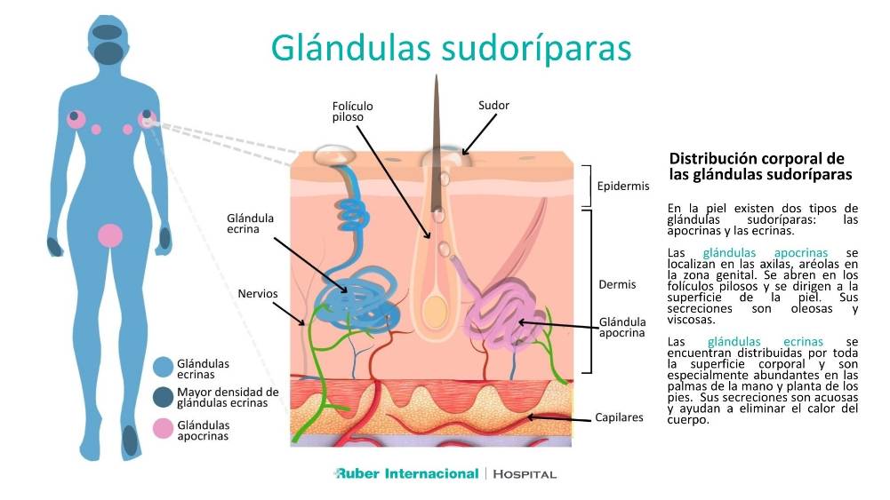 Hiperhidrosis tipos y distribuciónde glandulas sudoríparas